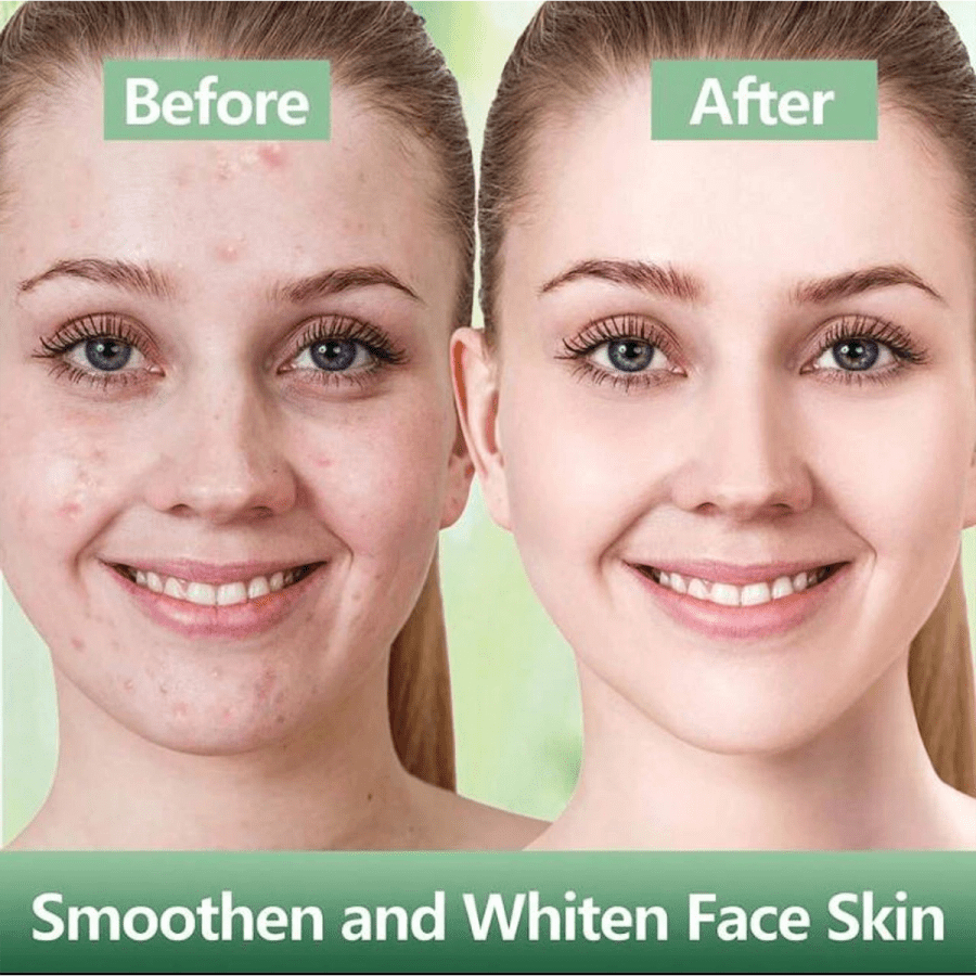 Skincare 211- Green Tea Mask For Face, Blackhead Remover With Green Tea Extract, Deep Pore Cleansing, Moisturizing, Skin Brightening For All Skin Types Of Men And Women
$8