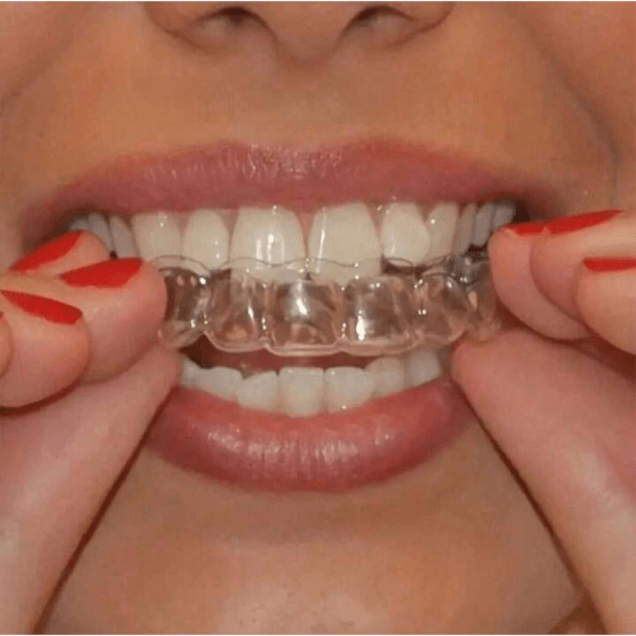 Beauty Other 211- 1/2/4/6pcs Dental Protective Trays, Soft EVA Material, Non-Sticky For Dental Care, Teeth Whitening Trays, Grinding Guards, Mouth Guards, Teeth Whitening EVA Trays, Suitable For Sports And Fitness, Boxing Protective Gear (Remember To Check The Size Before Purchasing, No Adhesive Effect, Needs To Be Used In Conjunction With Teeth Bite)
$3