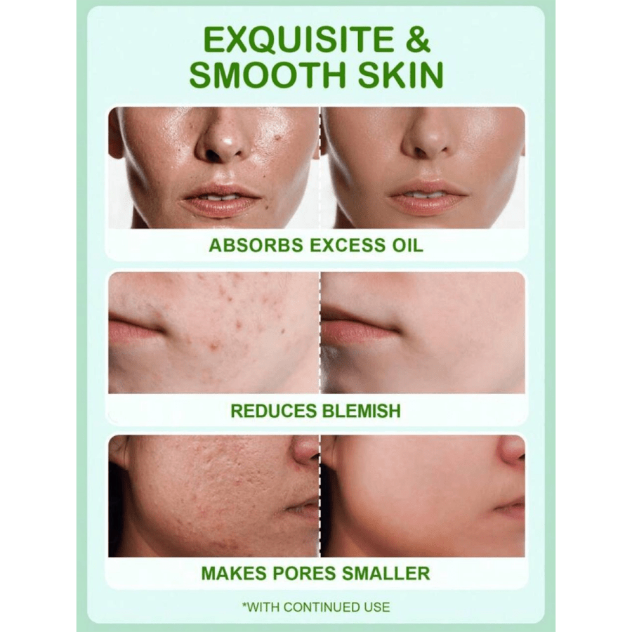 Body care 231- SlowSunday Salicylic Acid Anti-Blemish Gel
$4